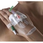Smith and Nephew IV 3000 1-Hand Delivery Dressing