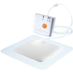 Pico Negative Pressure Wound Therapy
