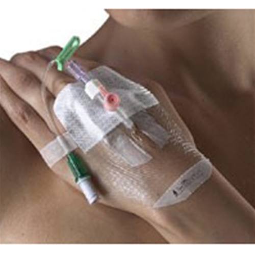 Smith and Nephew IV 3000 1Hand Delivery Dressing at
