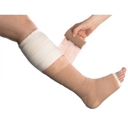 Smith and Nephew Proguide Compression System