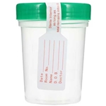 AMSure Sterile Specimen Container