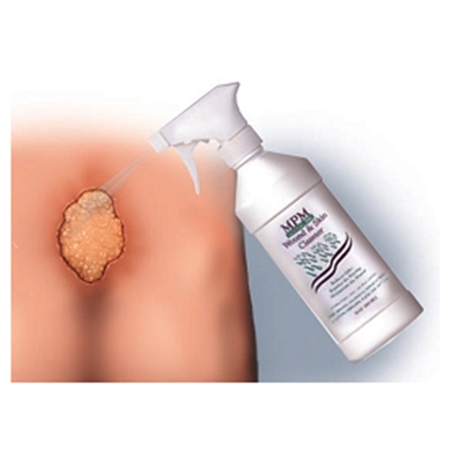 MPM Medical Wound & Skin Cleanser