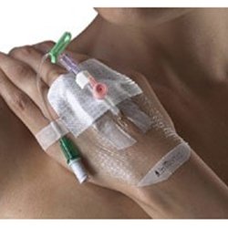 Smith and Nephew IV 3000 1-Hand Delivery Dressing
